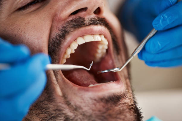 Best Oral Cancer Screening  in Middlesex, NJ